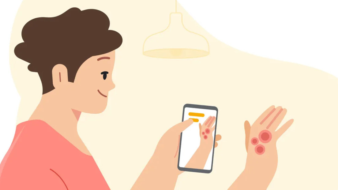 Google offers an app that helps users identify skin conditions with a mobile camera