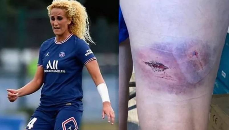 This is how PSG player Kheira Hamraoui’s legs and other limbs came out due to the attack  Football |  Sports