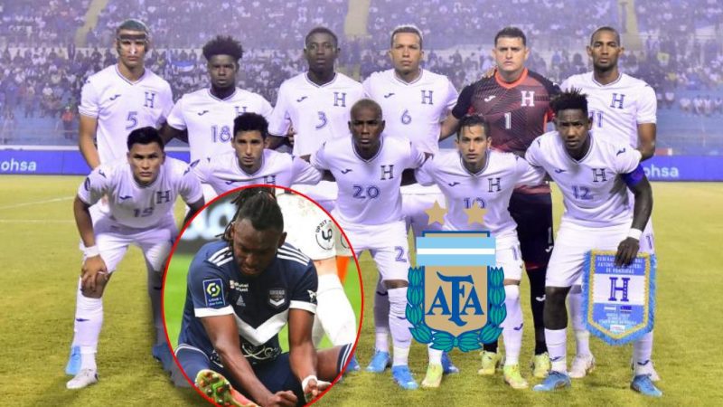Confident?  Important casualties for the Honduras national team in a friendly against Argentina