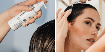 Antidot Pro Targets Growing Scalp Care Market With Sub- Treatment Kit